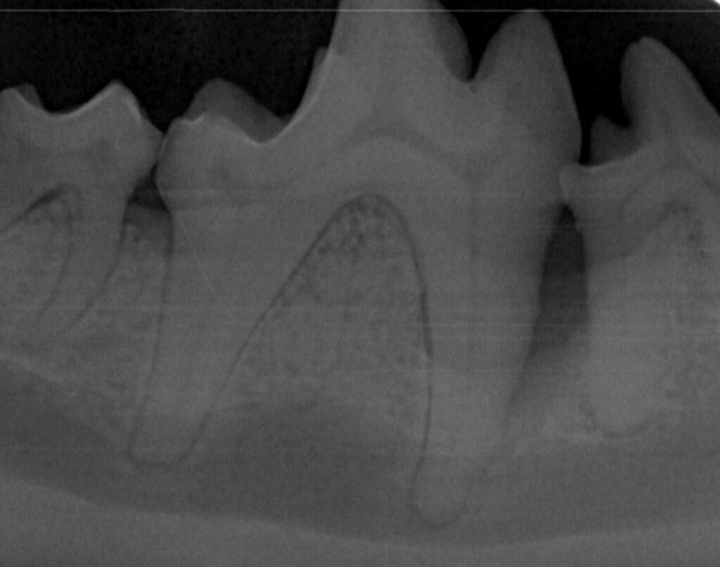 Periodontal kirurgi