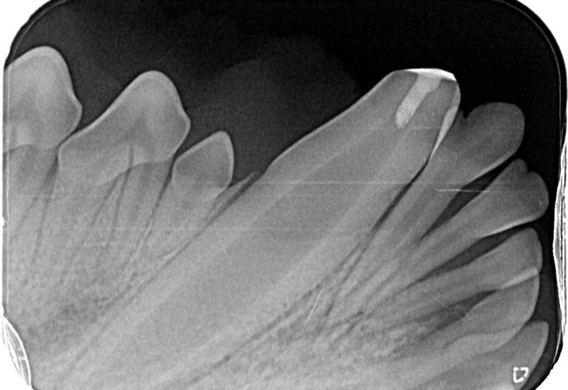 Vital-overkapning-rontgen