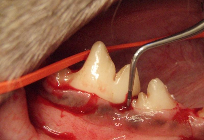 Periodontal kirurgi